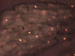 Cardamom ca oxalate in perisperm, 200x.jpg