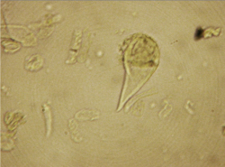 Cannabis sativa - OleMiss - Cystolithic trichrome.png