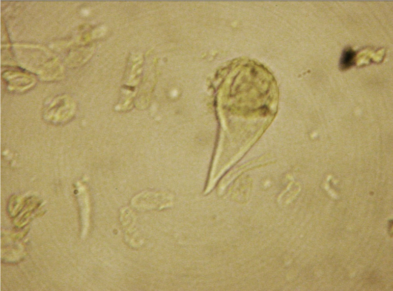 File:Cannabis sativa - OleMiss - Cystolithic trichrome.png