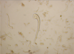 Cannabis sativa - OleMiss - Non-glandular trichrome.png