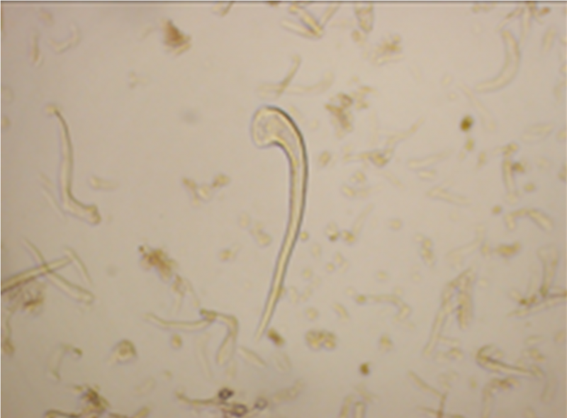 File:Cannabis sativa - OleMiss - Non-glandular trichrome.png