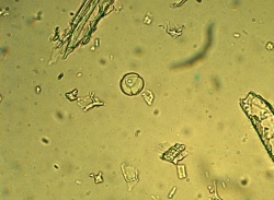 St johns wort pollen grain phytolab.jpg