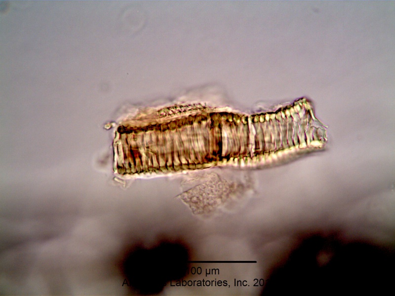 File:Astragalus membranaceus (Fisch. Ex Link) Bunge -Fabaceae--2.jpg