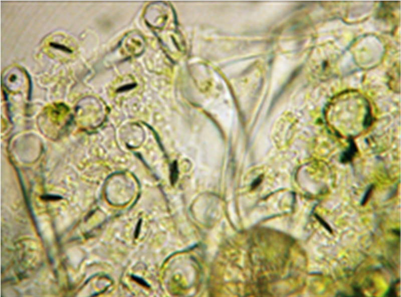 File:Cannabis sativa - OleMiss - Lower epidermis leaflet.png