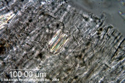 Ruscus aculeatus - Alkemist Laboratories.jpg