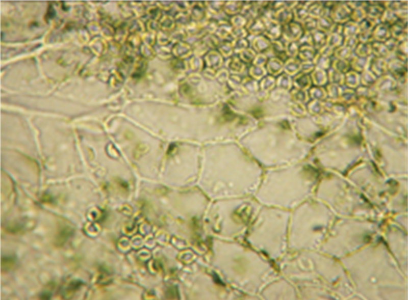 File:Cannabis sativa - OleMiss - Upper epidermis leaflet.png