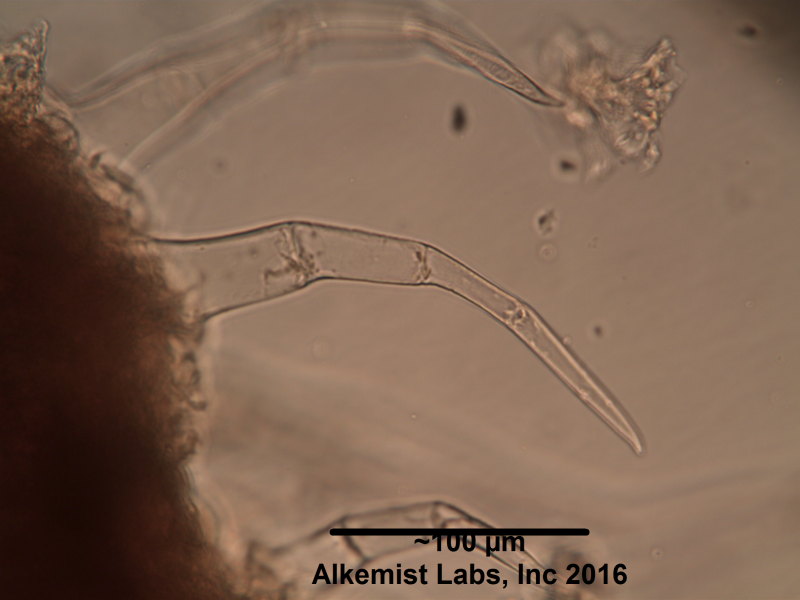 File:Ocimum tenuiflorum large multicellular covering trichome.png