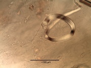 Achillea millefolium trichome.jpg